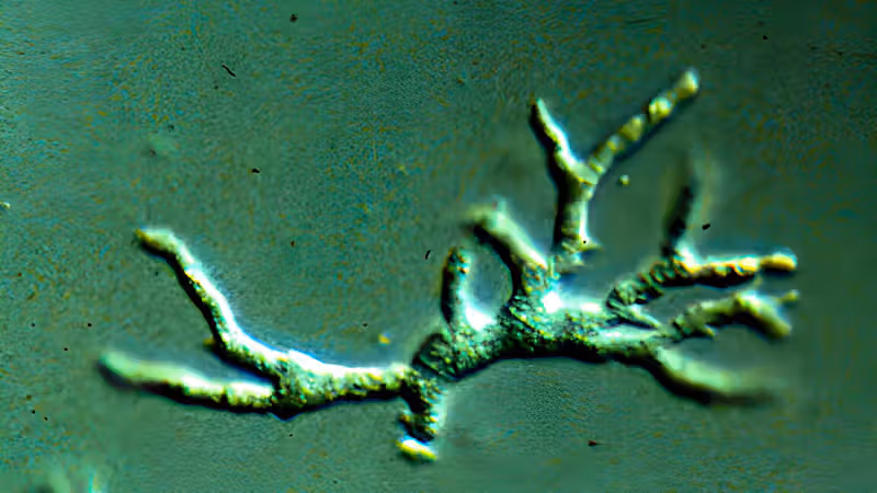 Toddler's tragic death from brain-destroying amoeba offers lessons for doctors