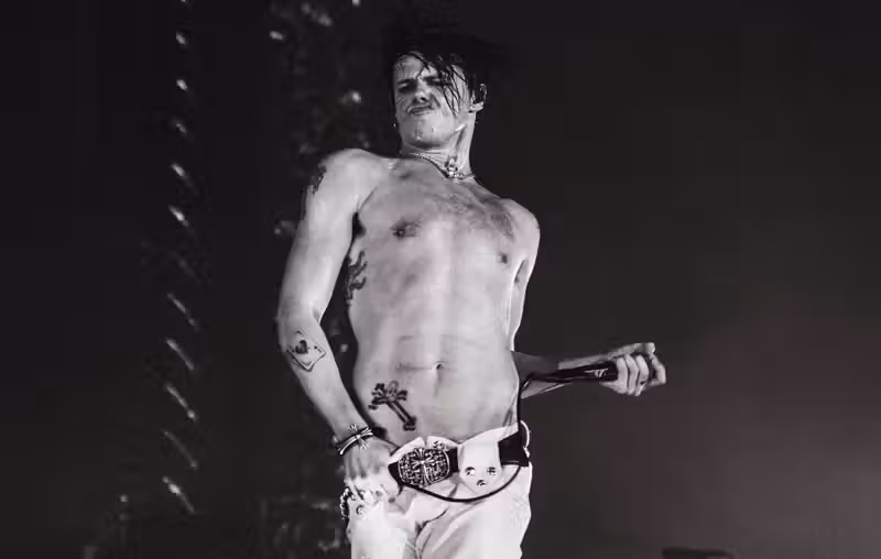 Yungblud breaks his leg in motorbike accident, vows to still play European festivals this week
